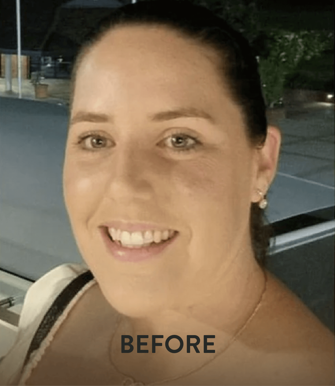 Alicia before